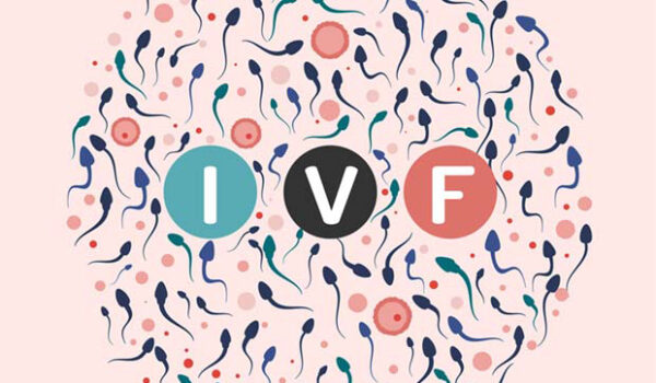 هر چیزی که قرار است درباره IVF بدانید