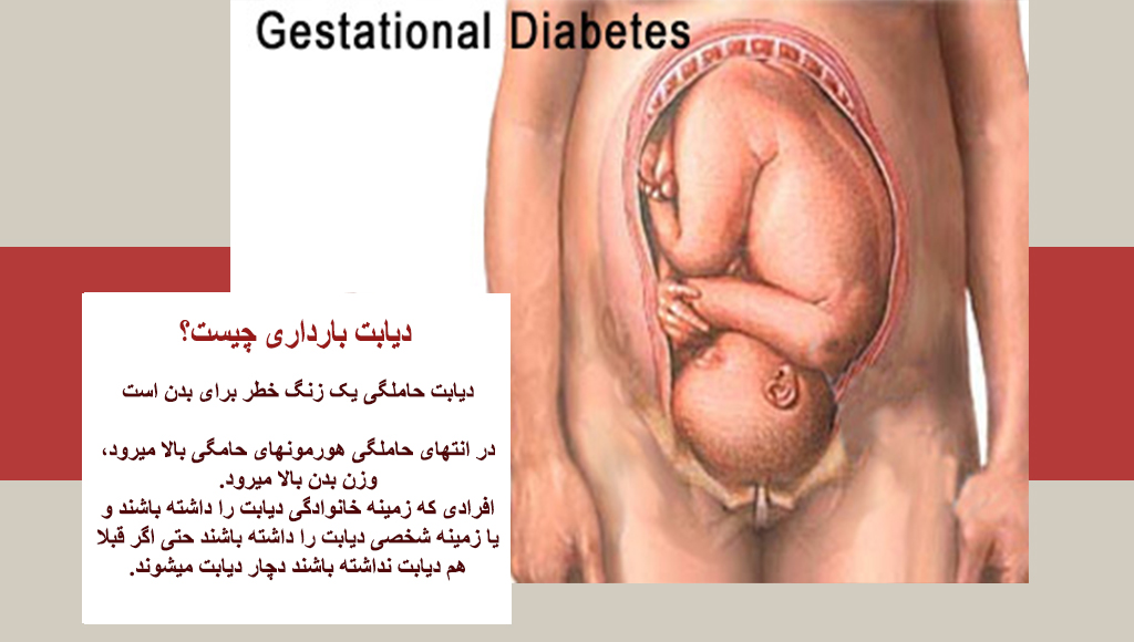 دیابت بارداری در ماه های اول