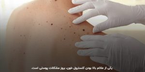 عوارض کلسترول بالا