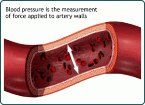علت فشار خون بالا